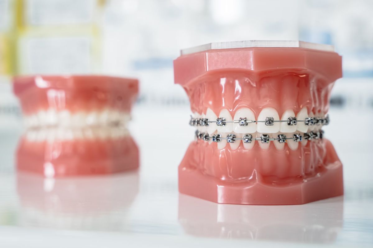dentistry improving your smile